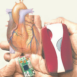Silicon Locket Cardiac Monitor